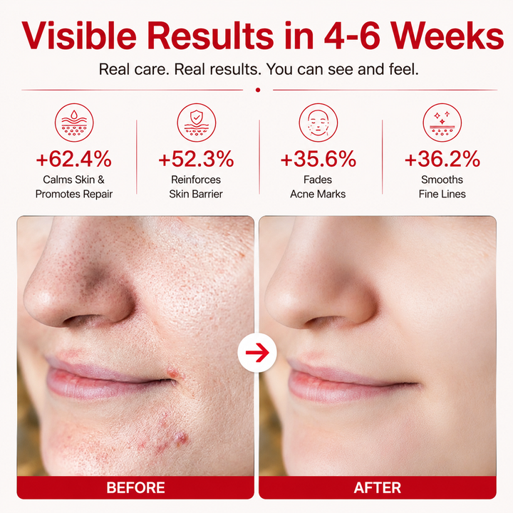 Premium LED Face Mask Light Therapy 4D Silicone Red Blue LED Mask 311 LEDs for Skin Care Wrinkles Acne Support Skin Tone Rejuvenation Home Device
