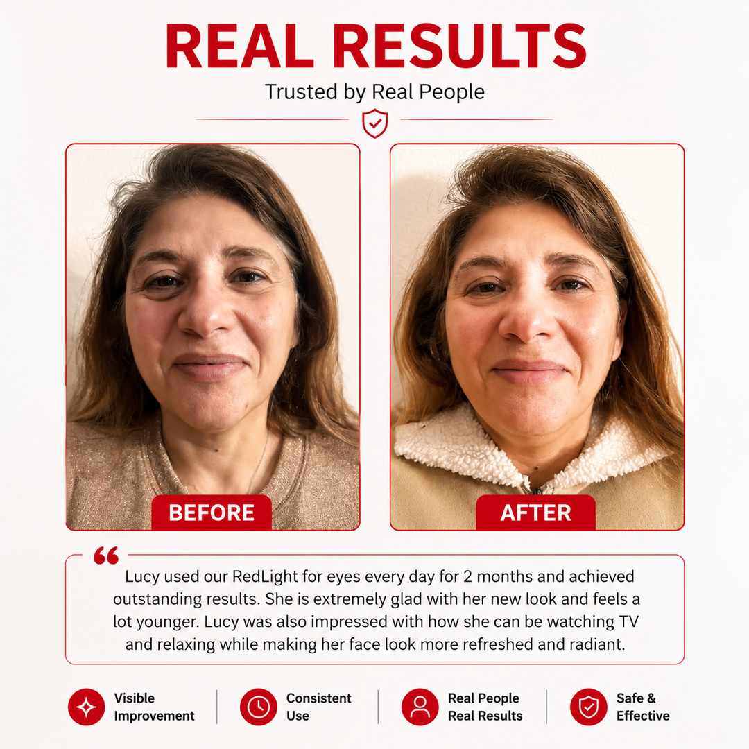 Premium LED Red Light Eye Massager EMS Under Eye Wrinkle Care Device Gel Patches Anti Aging Eye Therapy Rechargeable Type-C 2 Modes Auto Shut Off