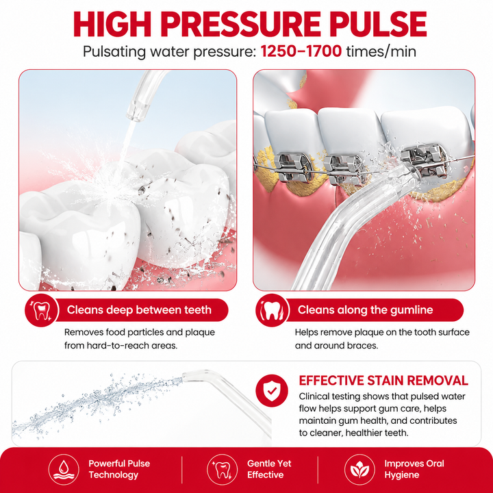 Premium Professional Oral Irrigator Water Flosser 1800 Pulses/min 800ml Tank 5 Tips Adjustable Pressure Electric Dental Cleaner Braces Implants Gum Care Home Use