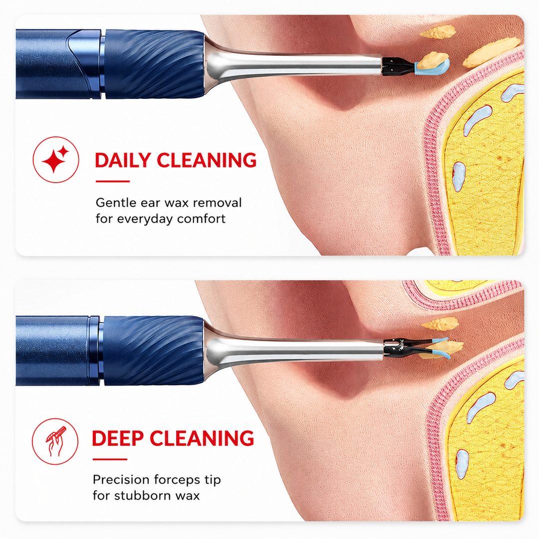 Premium Smart Ear Wax Removal Tool with Camera 12MP HD WiFi Otoscope LED Ear Cleaner for iPhone Android 3 in 1 Silicone Ear Pick Tweezers Kit