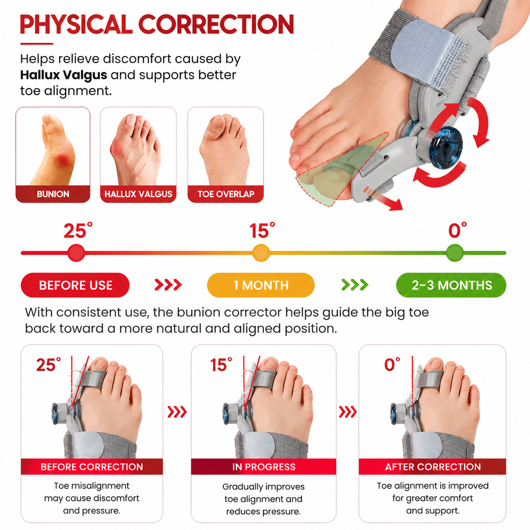 Premium Toe Alignment Support Adjustable Bunion Corrector Hallux Valgus Toe Separator Rotatable Splint Non Slip Big Toe Brace Daily Comfort Fit