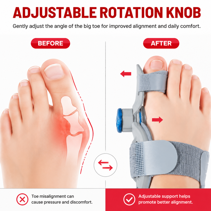 Premium Toe Alignment Support Adjustable Bunion Corrector Hallux Valgus Toe Separator Rotatable Splint Non Slip Big Toe Brace Daily Comfort Fit