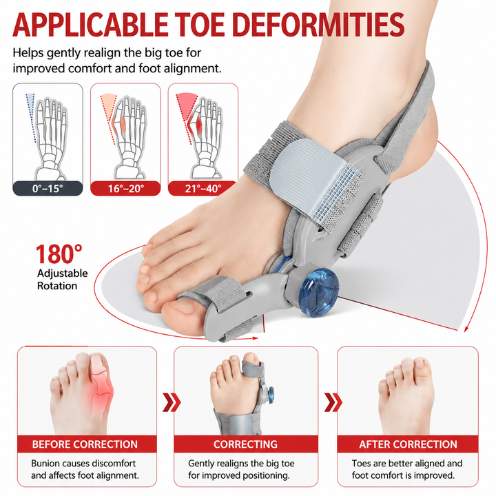 Premium Toe Alignment Support Adjustable Bunion Corrector Hallux Valgus Toe Separator Rotatable Splint Non Slip Big Toe Brace Daily Comfort Fit
